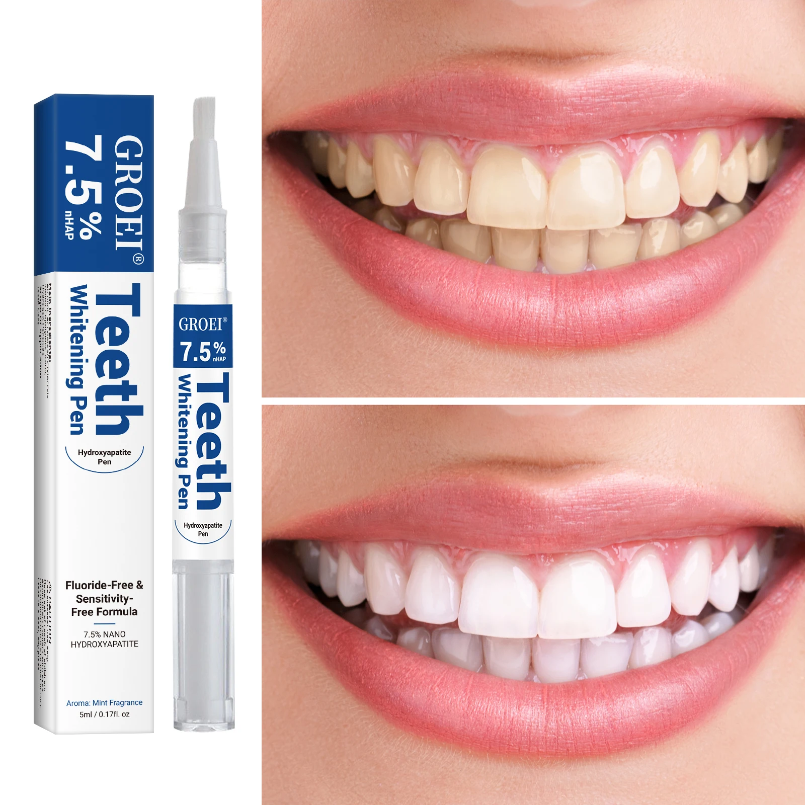 Penna per sbiancamento dei den - Teeth Whitening Pens recensione e prezzo