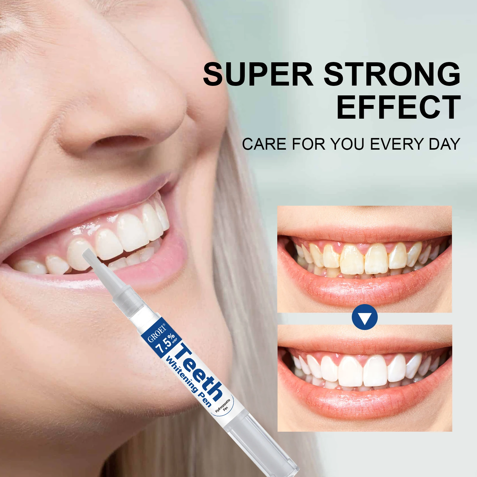 Penna per sbiancamento dei den - Teeth Whitening Pens recensione e prezzo