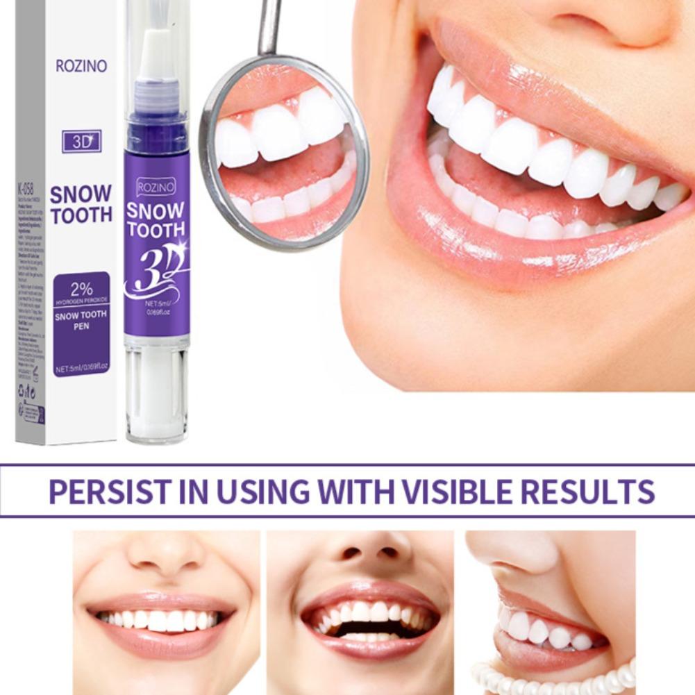 Penna sbiancante per denti 3D, - Teeth Whitening Pens recensione e prezzo